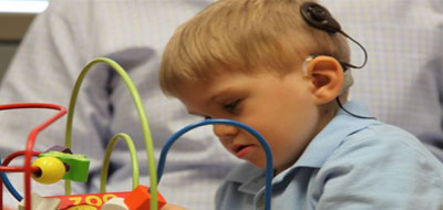 الطب يعيد السمع لطفل